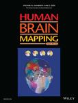 HUMAN BRAIN MAPPING《人脑图谱》