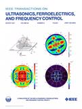 IEEE Transactions on Ultrasonics, Ferroelectrics, and Frequency Control（或：IEEE TRANSACTIONS ON ULTRASONICS FERROELECTRICS AND FREQUENCY CONTROL）《IEEE超声学、铁电体技术与频率控制汇刊》