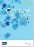 Cancer Cytopathology《癌症细胞病理学》