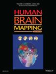 Human Brain Mapping《人脑图谱》