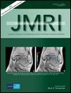 Journal of Magnetic Resonance Imaging《磁共振成像杂志》